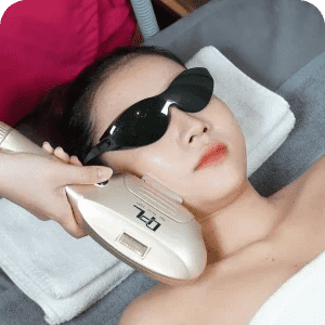 Điều trị mụn, nám