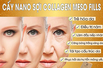 Cấy NANO Sợi Collagen Meso Fills